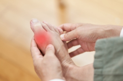 Risk Factors and Signs of Gout